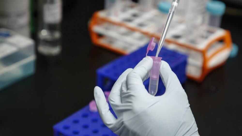 Llegó el pico de la pandemia: ¿Colombia está preparada?