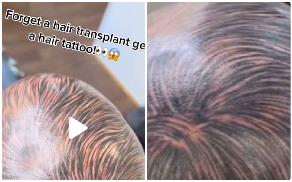 Insólito: hombre se tatuó la cabeza para “disimular” la calvicie