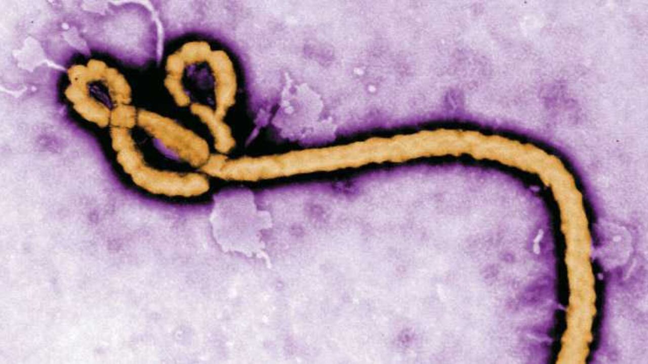 Ébola en el semen.