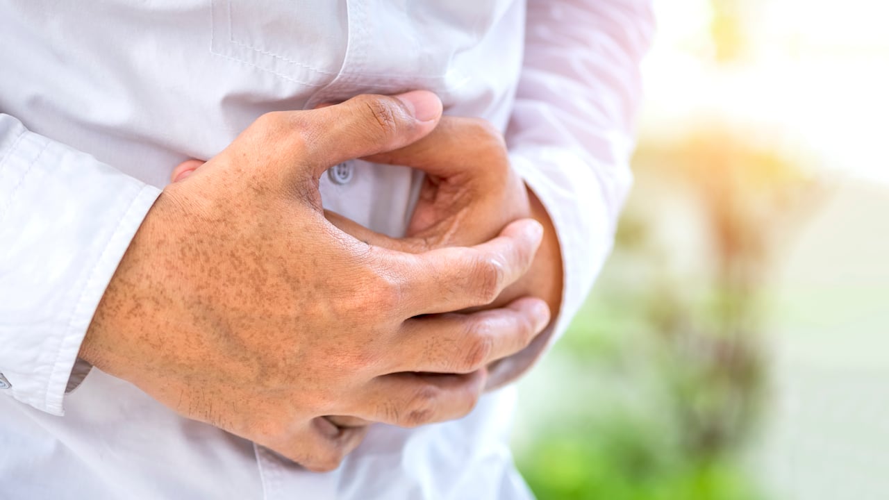 Existen alternativas para bajar la hinchazón y recudir las molestias.