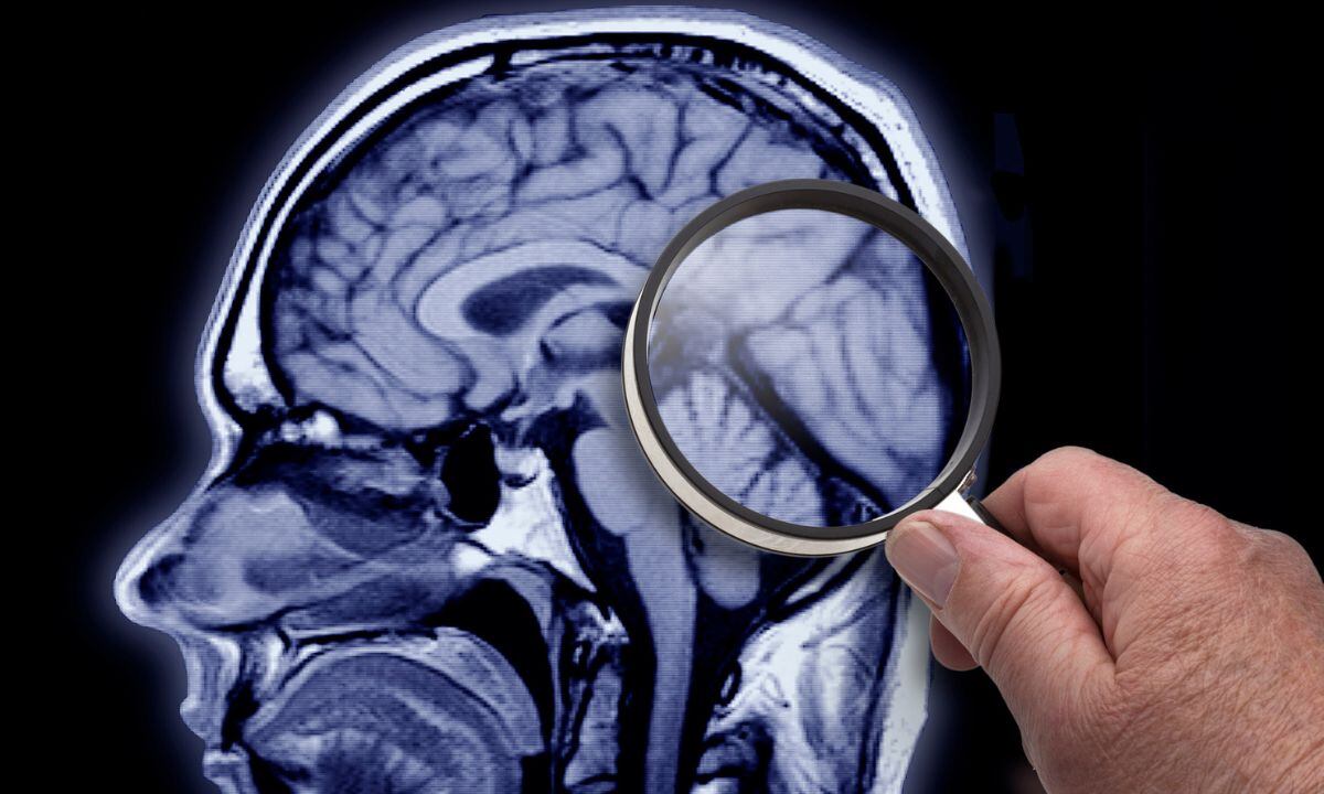 Hábito que daña al cerebro.