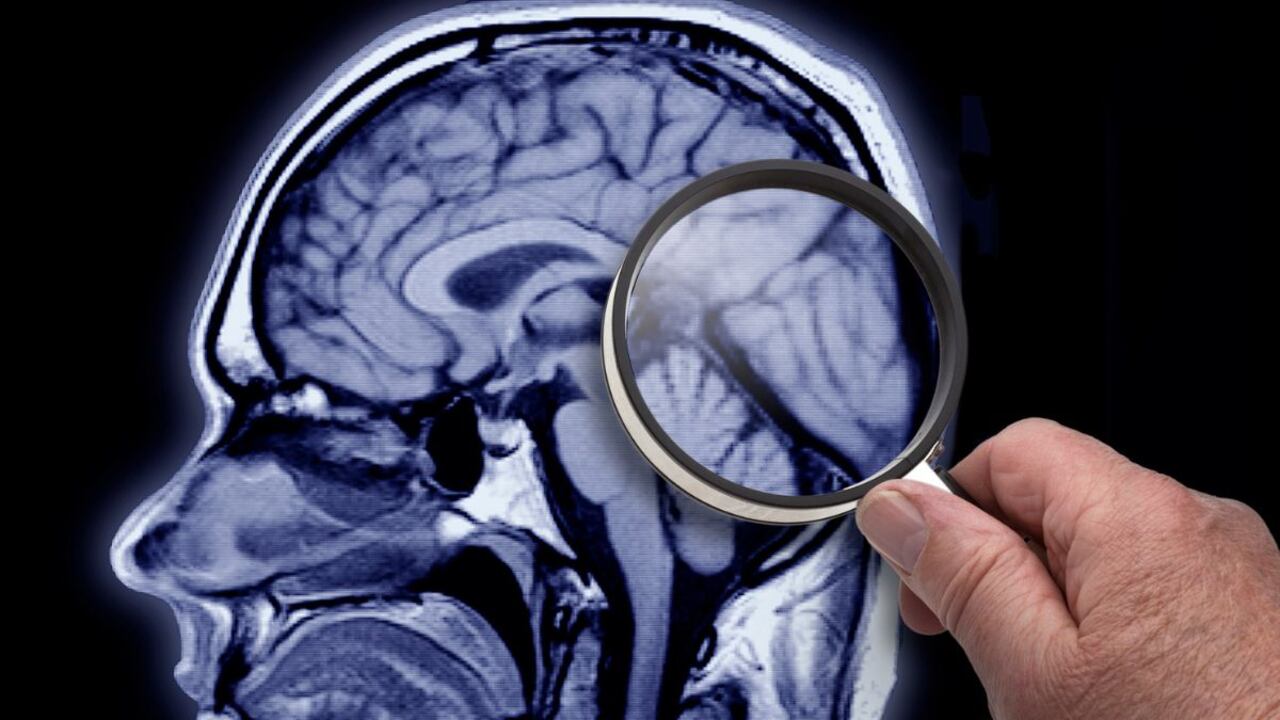 Hábito que daña al cerebro.