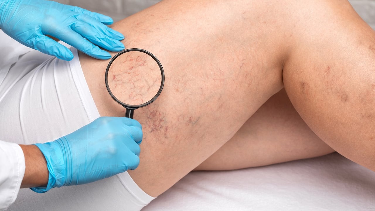 Las piernas son muy dadas a tener problemas de circulación.