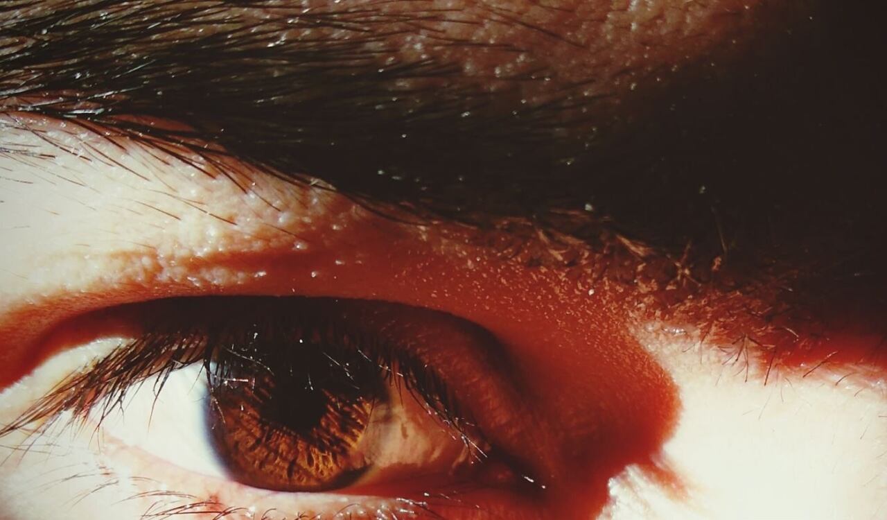 Los párpados caídos también se pueden tratar con ejercicios y remedios naturales