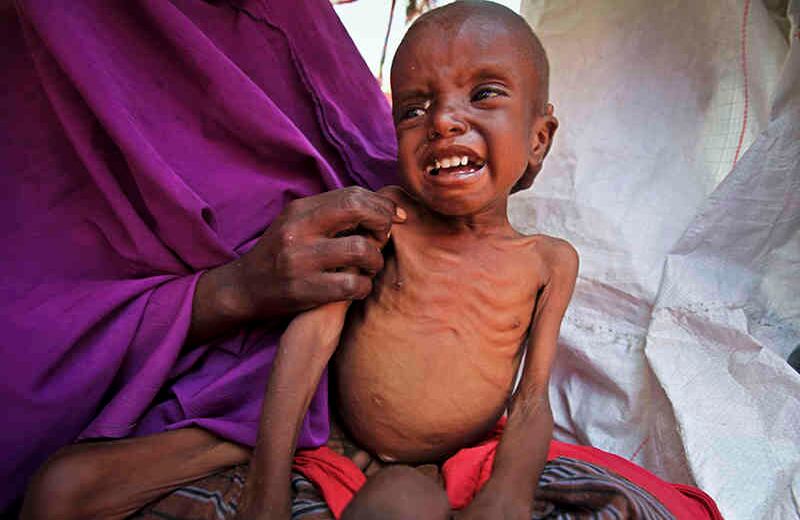 La recién desplazada madre somalí Sahra Muse, de 32 años, consuela a su niño desnutrido, Ibrahim Ali, de 7 años, en su refugio provisional en un campamento en el área de Garasbaley en las afueras de Mogadishu, Somalia (Foto del AP / Farah Abdi Warsameh)