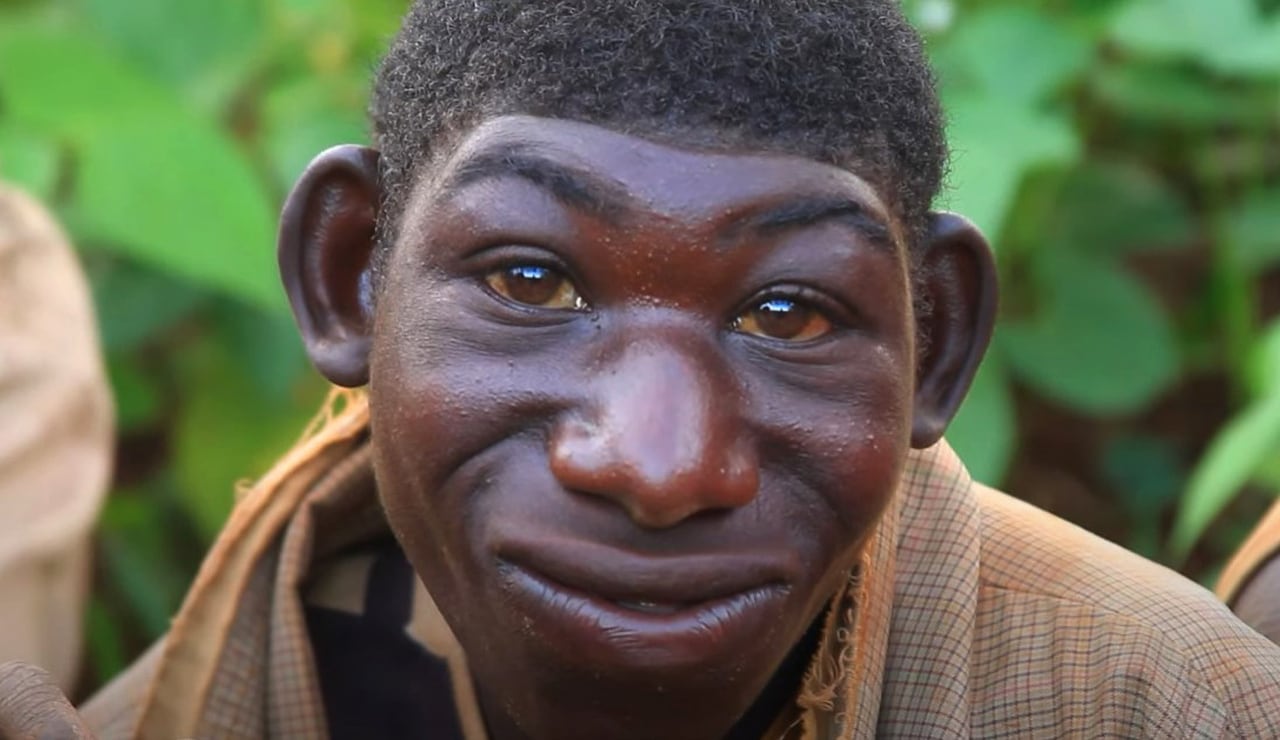 El joven ha logrado socializar poco a poco con más personas y realizar actividades que parecían imposibles para él.