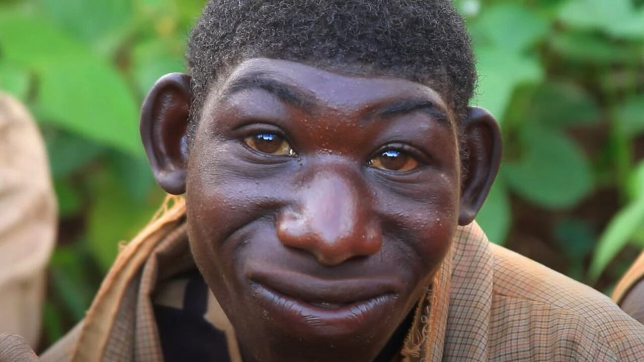 El joven ha logrado socializar poco a poco con más personas y realizar actividades que parecían imposibles para él.