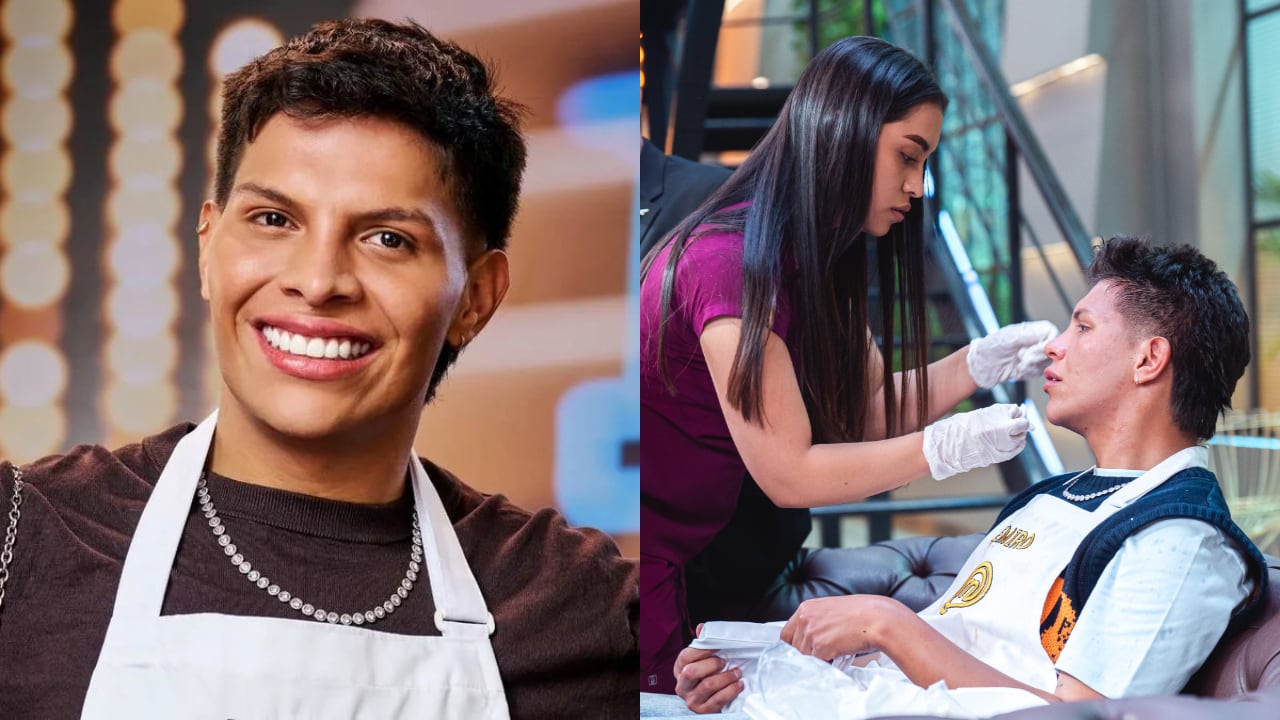 Emiro Navarro se quemó la cara con una carimañola en 'MasterChef Celebrity'.