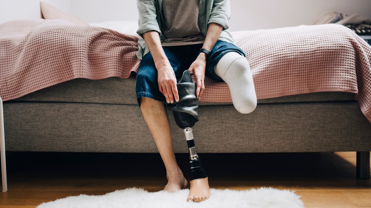 El dolor fantasma puede causar gran molestia en la rutina diaria.
