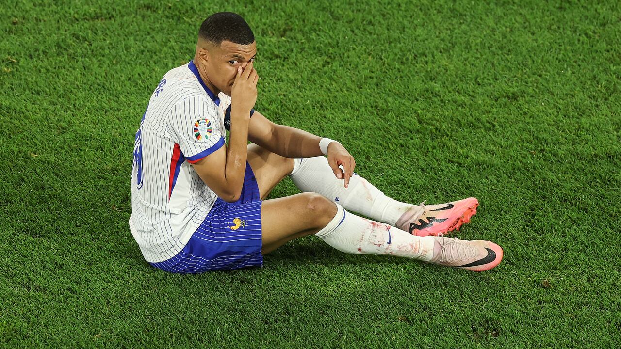 Esto fue lo que dijo el jugador francés tras confirmarse que se rompió la nariz.