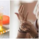 Representación de uno de los síntomas que produce el aumento de ácido úrico en el cuerpo.