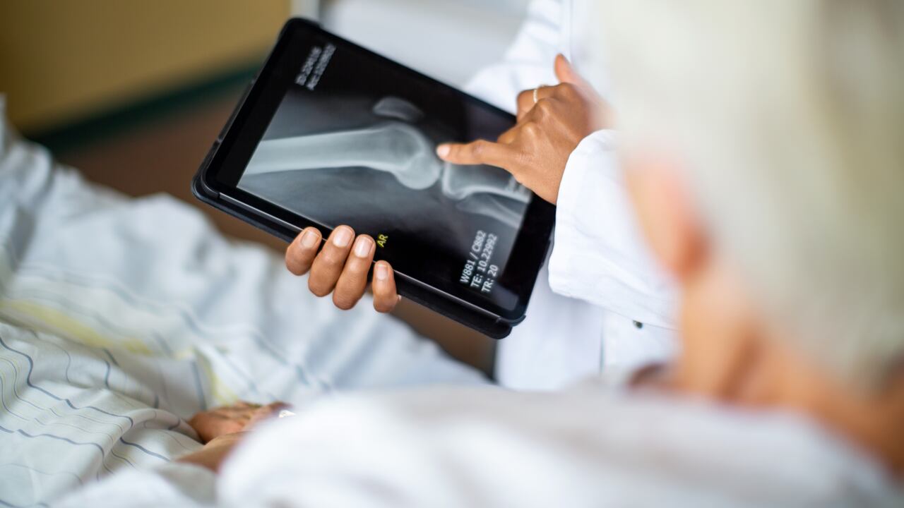 Los huesos dan soporte y permiten la movilidad del cuerpo, además, protegen de lesiones al cerebro, al corazón y a otros órganos.