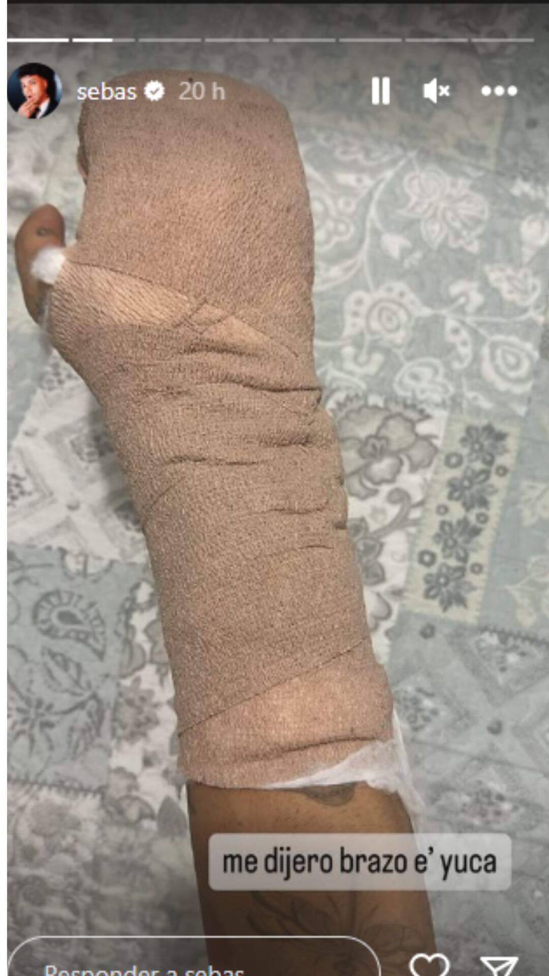 Así quedo la mano derecha de Sebastián Villalobos.