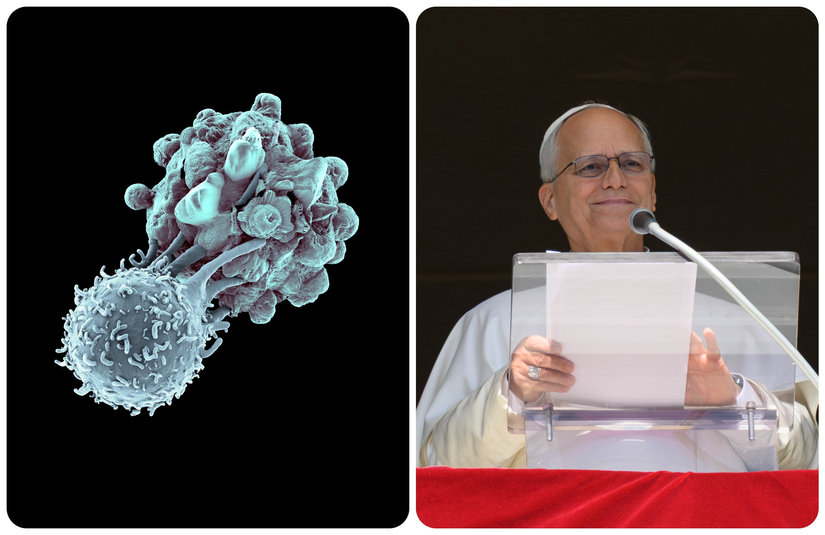 El papa León XIV supera con éxito intervención pulmonar por un adenocarcinoma.