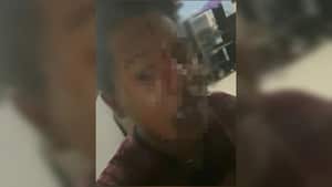 Presunto caso de agresión policial en Cartagena.