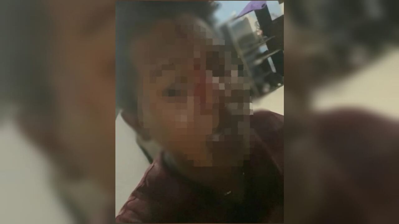 Presunto caso de agresión policial en Cartagena.