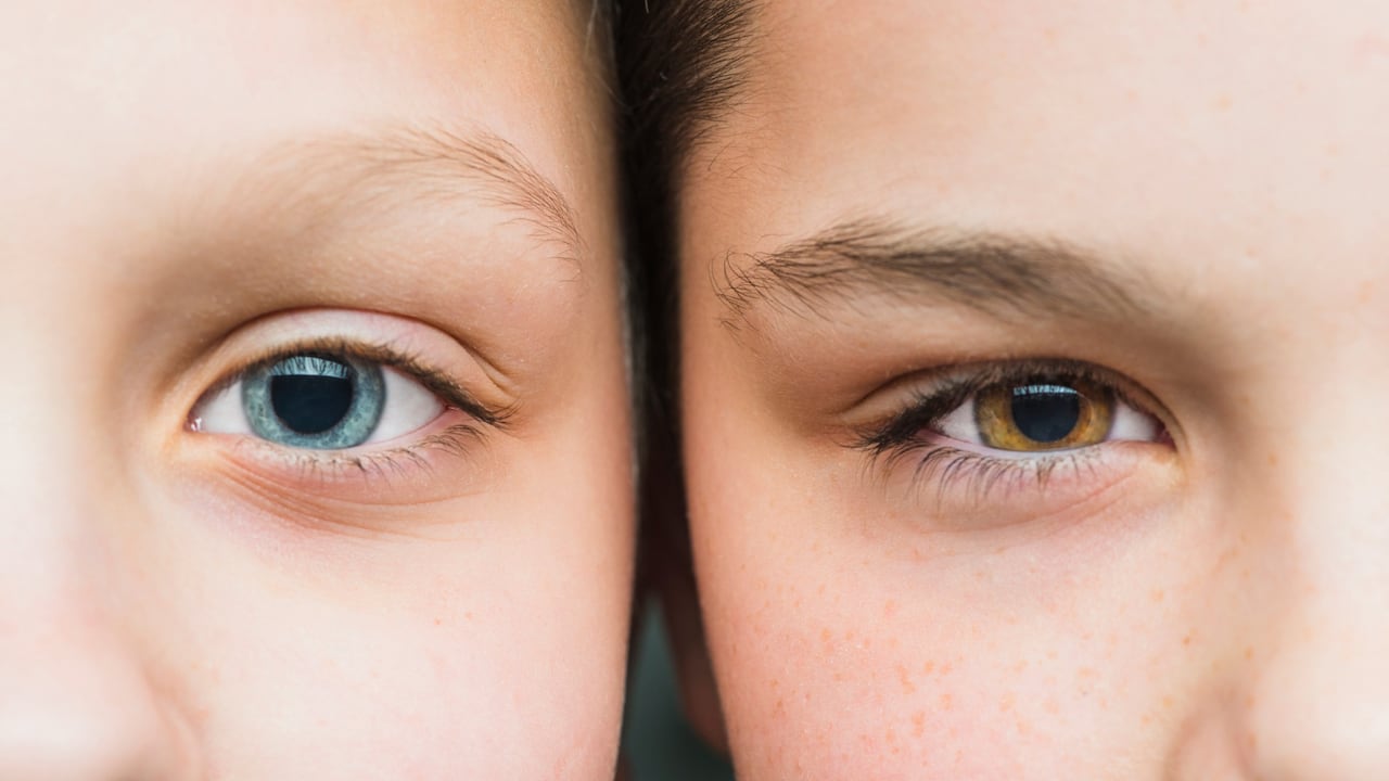 La queropigmentación es una operación que, por medio del láser, busca cambiar el color de los ojos alterando el color natural del mismo.