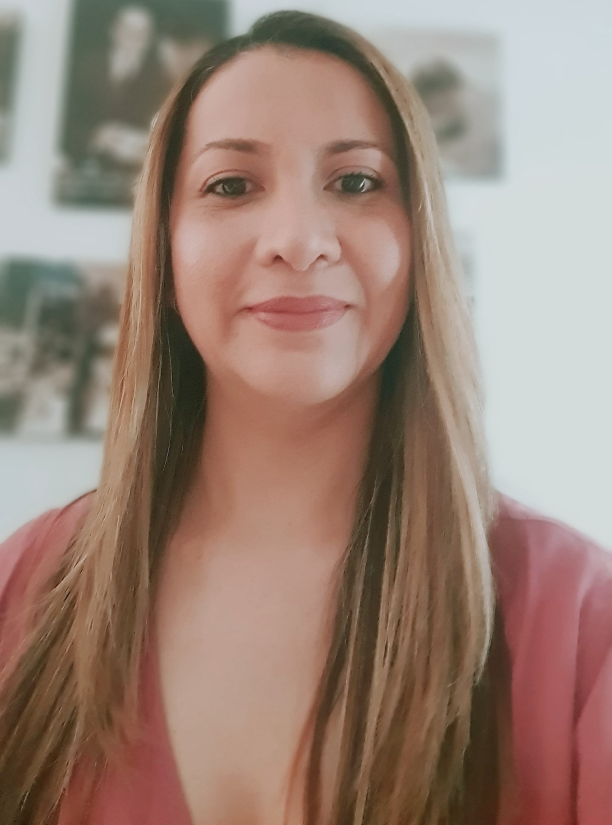 Gladys Ortiz, paciente de Enfermedad Ocular Tiroidea (EOT).