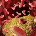 Es importante diferenciar a los Los triglicéridos del colesterol. Lo importante es mantener estables sus niveles en el organismo. Foto: Getty Images.