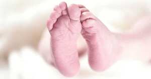 Los médicos del hospital aseguraron que fue un caso complicado, ya que el gemelo parásito estaba conectado a los órganos vitales del gemelo vivo