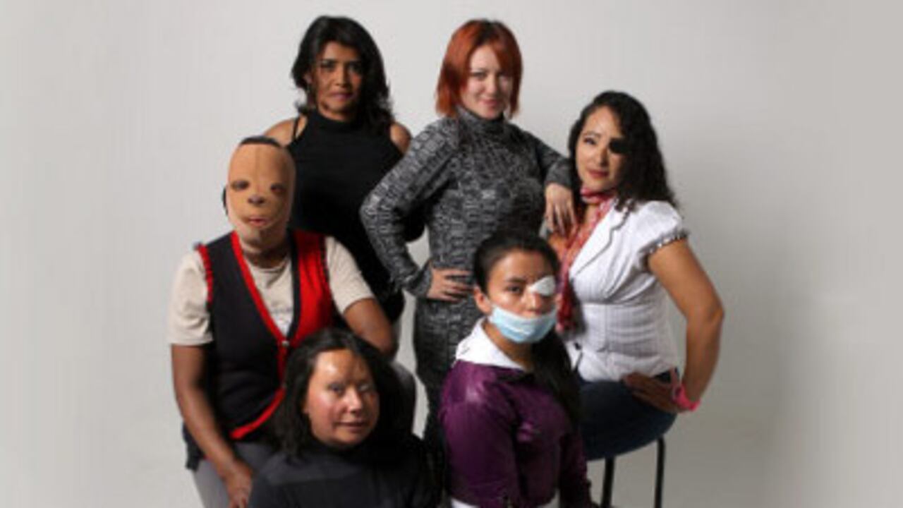 La Revista Semana destacó recientemente el caso de seis mujeres quemadas.