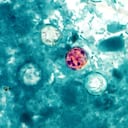 Cyclospora cayetanensis