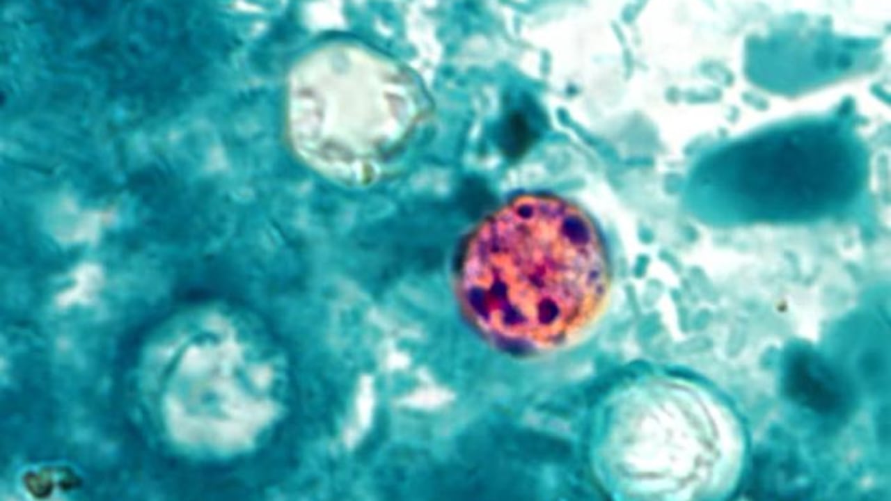 La ciclosporiasis se transmite principalmente por el consumo de alimentos o agua contaminados.