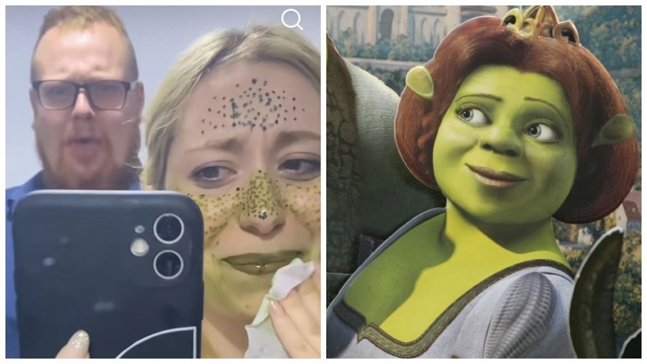 Takwa Larsen, de 26 años, compartió su experiencia en redes sociales luego de utilizar un bolígrafo de henna para generar pecas en su piel.