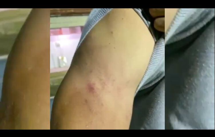 El joven que trabaja como recogebolas en el Estadio Alberto Grisales dice que Paulo Autuori lo aruñó