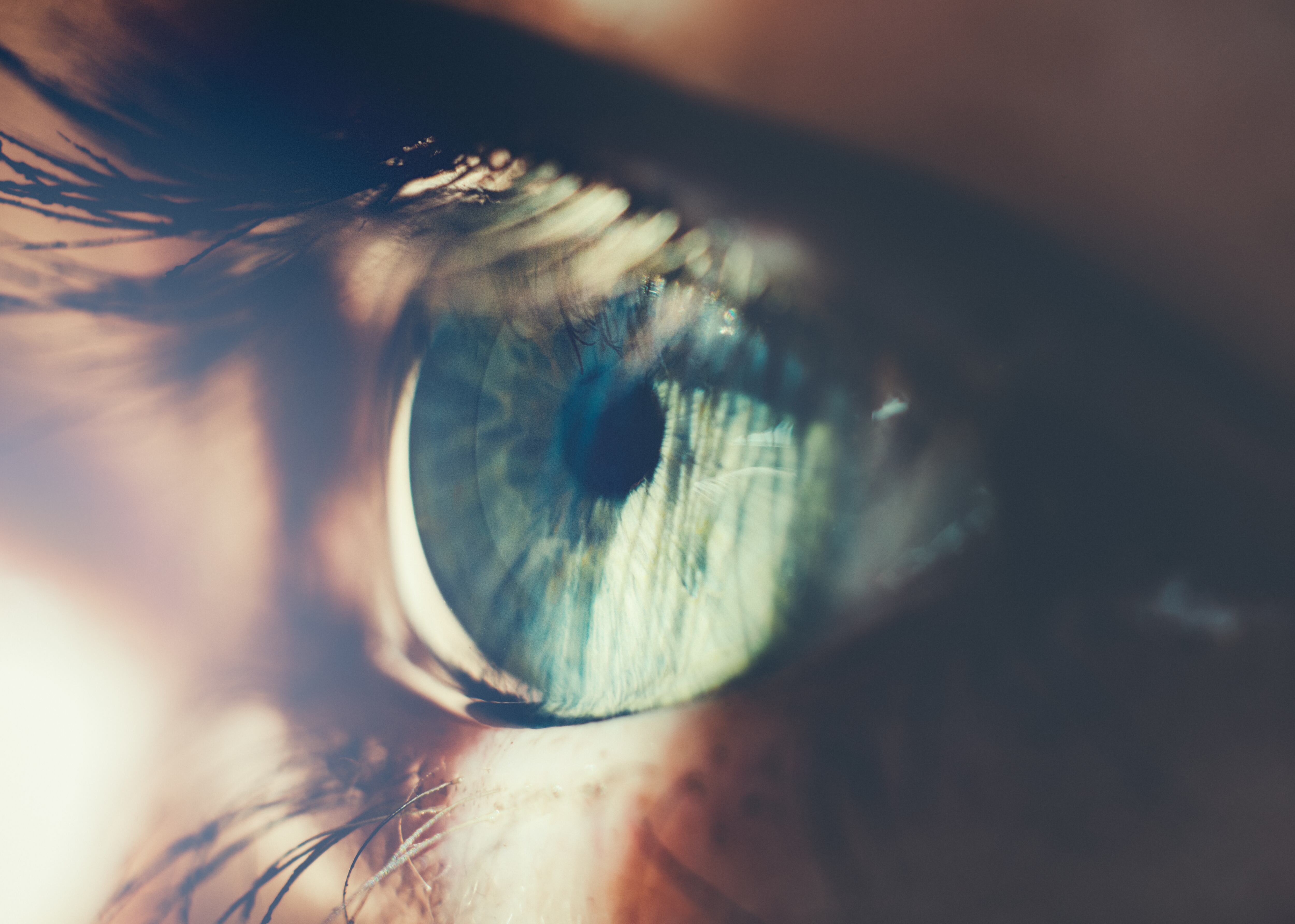 Pterigión o carnosidad en los ojos: estos son los síntomas, causas y tratamiento