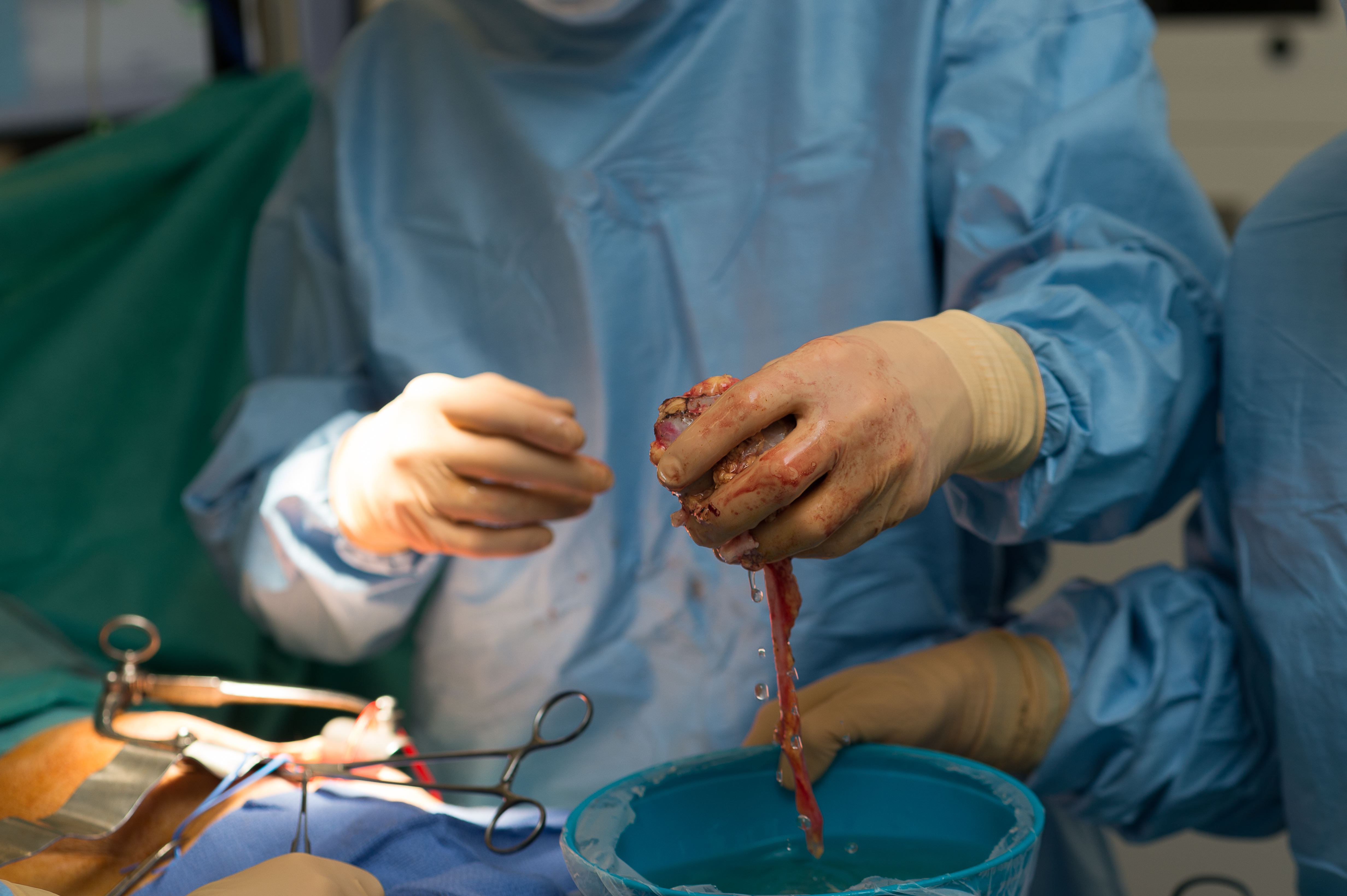 Imagen de referencia - Foto: BSIP/Universal Images Group. Vía Getty Images.