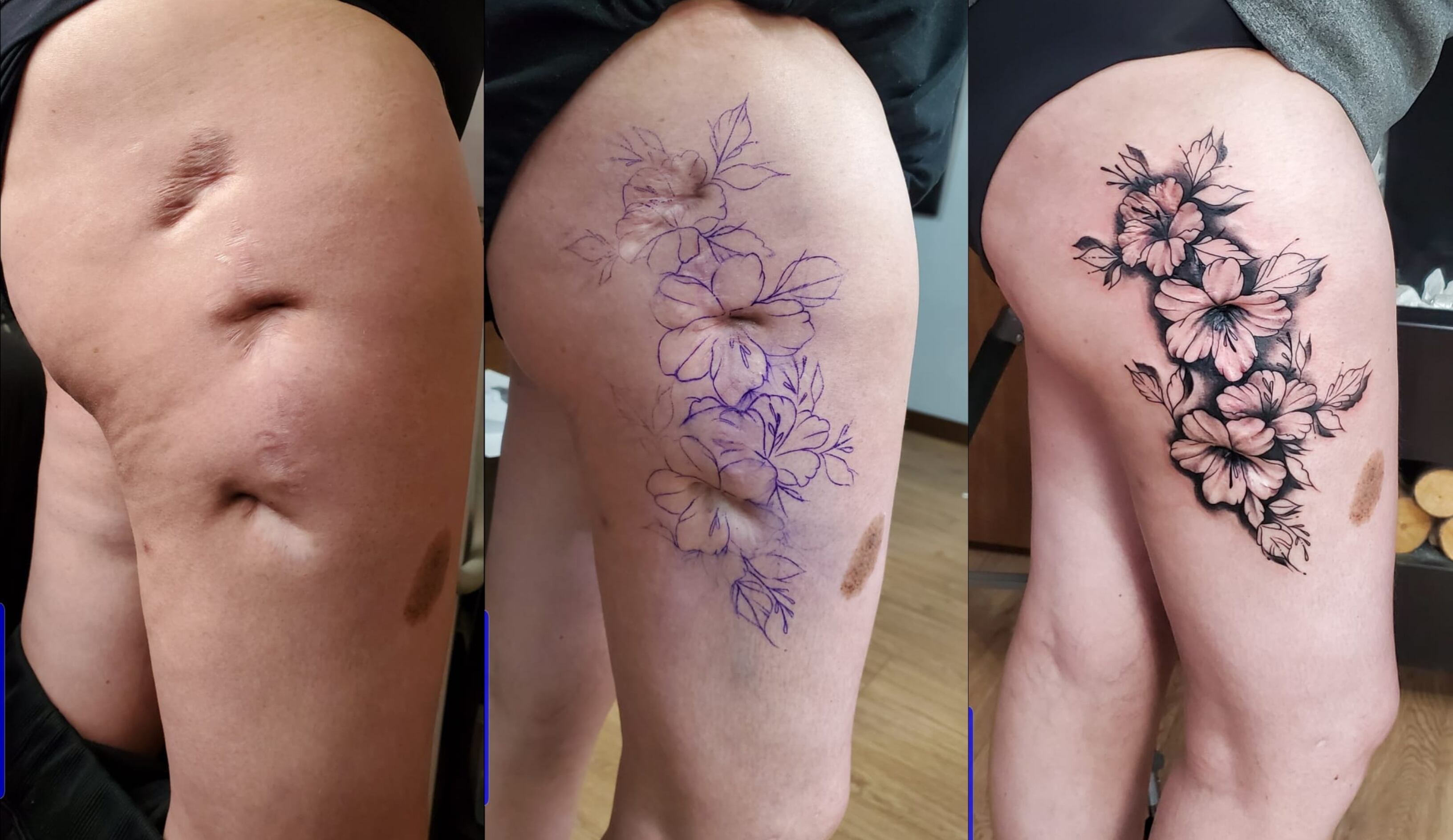 Cubrimiento de cicatriz en la pierna.