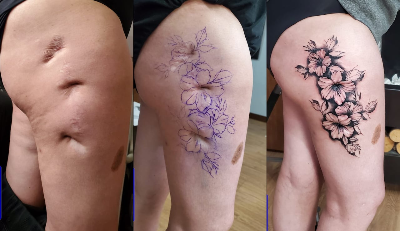 Cubrimiento de cicatriz en la pierna.