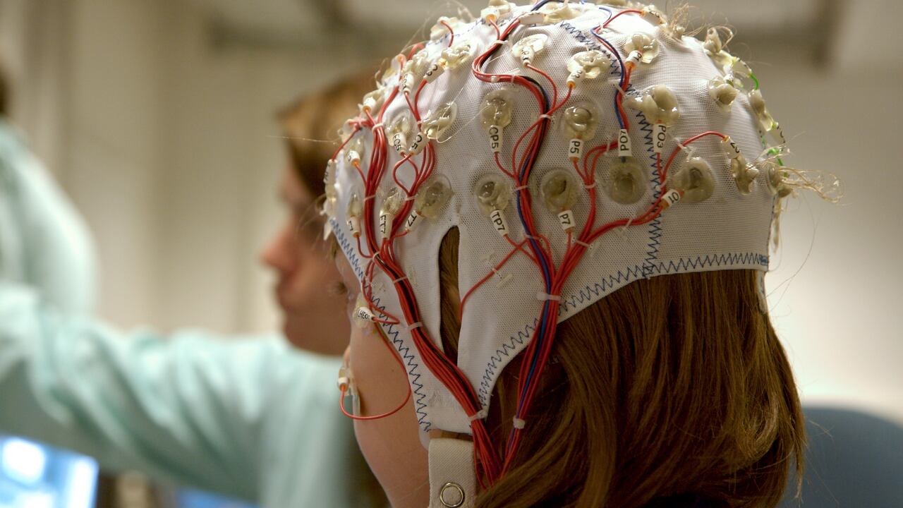 Foto de referencia sobre el análisis del cerebro de un menor de edad