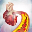 Este tipo de grasa al acumularse en las arterias impide el flujo sanguíneo.