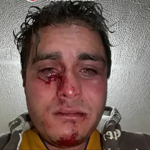 Así quedó la cara de Axl Cárdenas luego del brutal ataque en el intento de atraco.