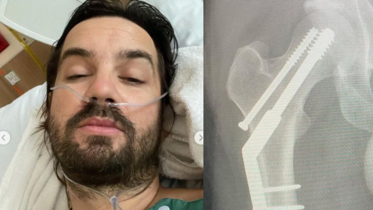 Kevin Parker, de Tame Impala, fue operado de urgencia tras sufrir una fractura en la cadera.