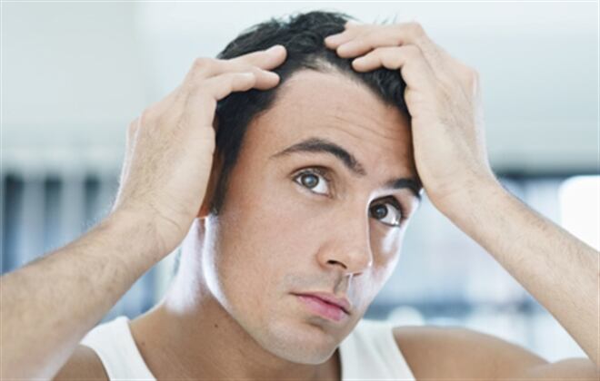 Hay varios remedios caseros para prevenir la calvicie.