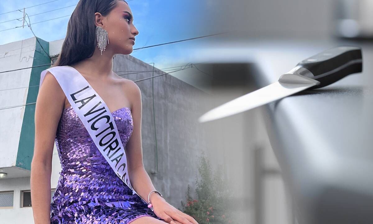 Mya sobrevivió a un brutal ataque por parte de su novio y ahora eleva su voz para pedir a otras mujeres que enuncien casos de maltrato.