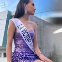 Mya sobrevivió a un brutal ataque por parte de su novio y ahora eleva su voz para pedir a otras mujeres que enuncien casos de maltrato.