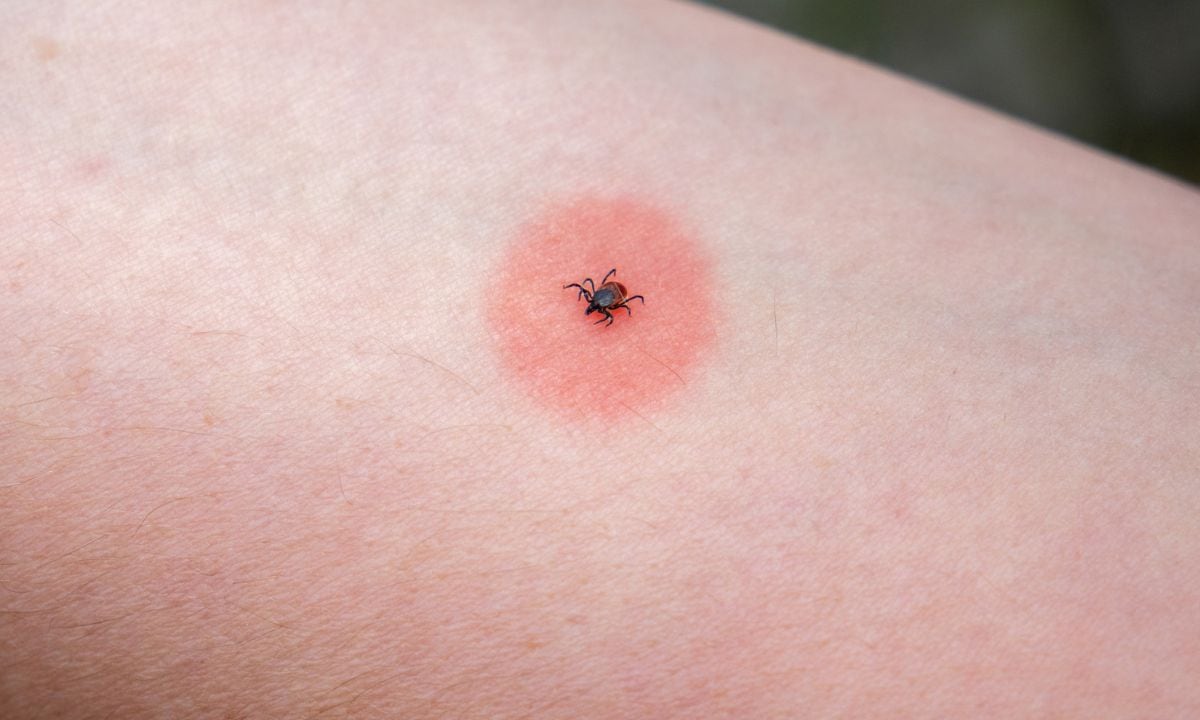Vinagre de manzana para eliminar las garrapatas.