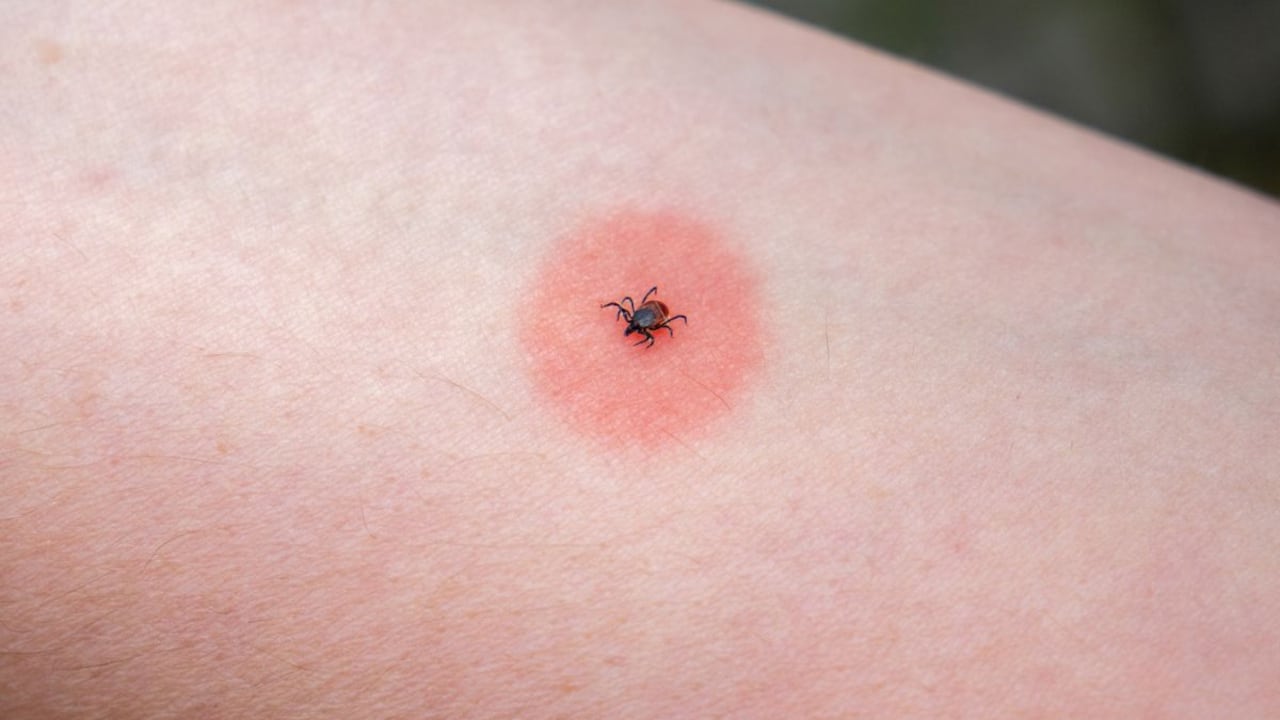 Vinagre de manzana para eliminar las garrapatas.