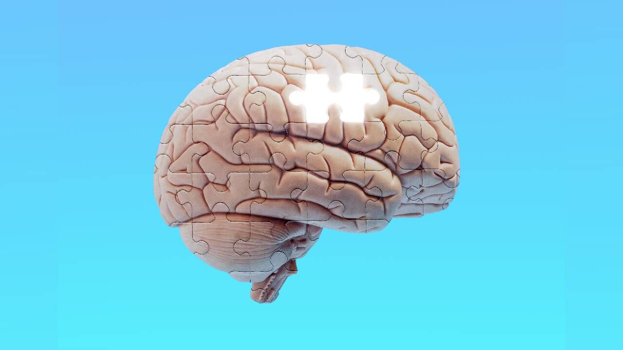 Mayo Clinic señala que el consumo de grandes cantidades de alcohol provoca cambios en el cerebro. Foto: GettyImages.