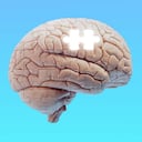 Mayo Clinic señala que el consumo de grandes cantidades de alcohol provoca cambios en el cerebro.