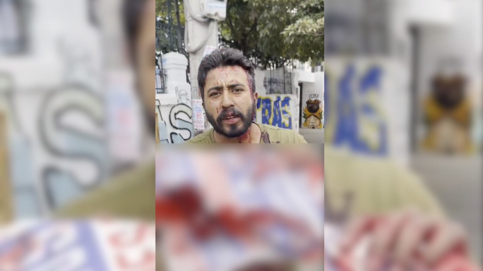 Iván Díaz candidato al Concejo de Bogotá, es atacado en la Universidad Pedagógica cuando intentaba hacer proselitismo político