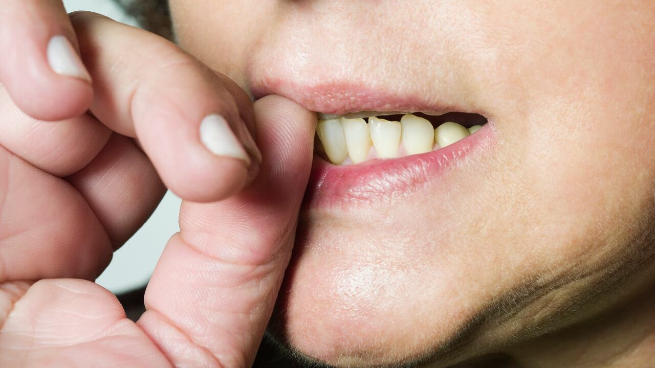 La onicofagia está relacionada con la ansiedad.