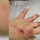 Al parecer Ana Camila Blanco habría apuñalado a Daniela Gualteros.