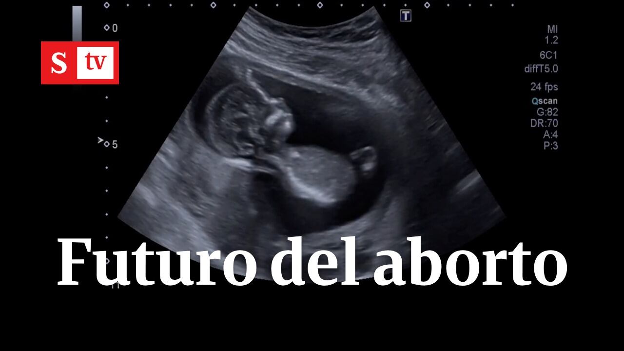 Aborto en Colombia