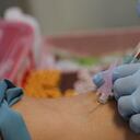 Un paciente británico que se sometió a un trasplante de células madre completó 18 meses sin tratamiento retroviral para el VIH.