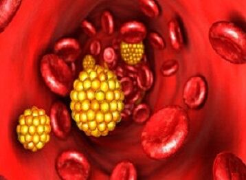 Se cree que el colesterol HDL recoge el exceso de colesterol malo que hay en la sangre y lo lleva al hígado para eliminarlo,